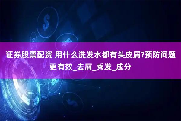 证券股票配资 用什么洗发水都有头皮屑?预防问题更有效_去屑_秀发_成分